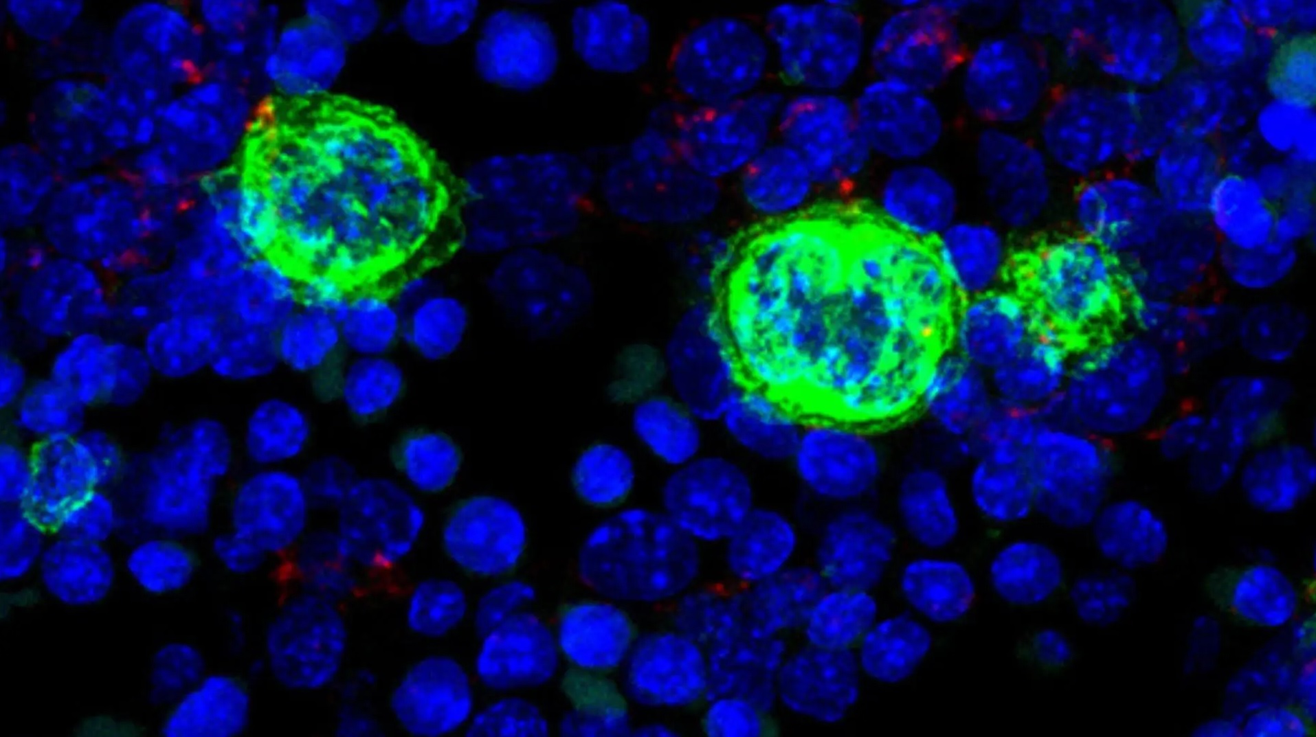 Imagen que muestra el proceso de fragmentación de los megacariocitos presentes en tejido. Marcado con un anticuerpo específico para megacariocitos en color verde se puede visualizar el sistema de demarcación de membranas previo a la explosión y posterior liberación de las plaquetas. Fuente: Laboratorio de Inmunobiología del Centro nacional de Microbiología del ISCIII.