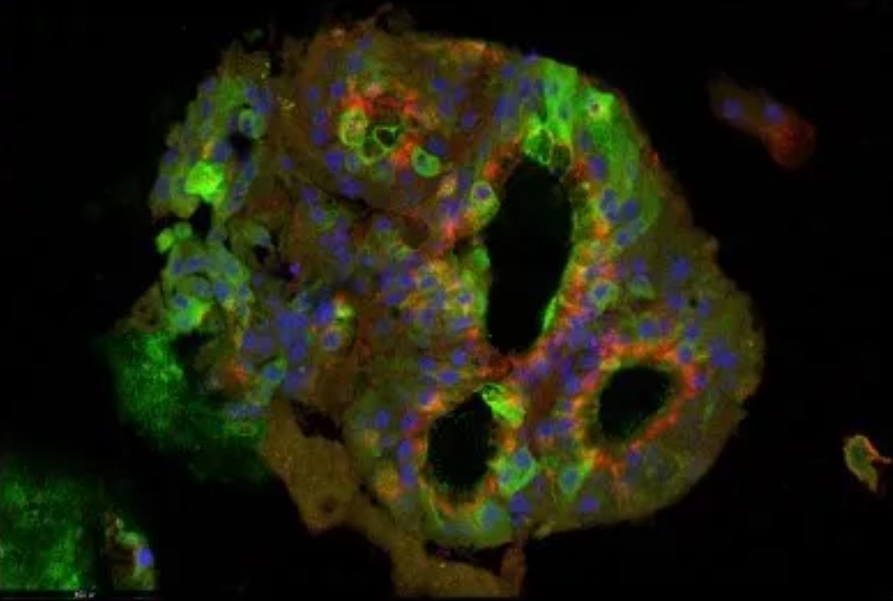 imagen en un microscopio confocal de la expresión de marcadores hepáticos mediante inmunofluorescencia. Fuente: Nerea Matamala, Unidad de Genética Molecular, ISCIII.