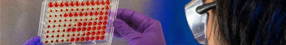 Photograph of a person looking at blood projections